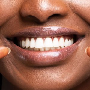 Black woman smiling with perfectly white teeth / Dentist in Prescott Valley, AZ